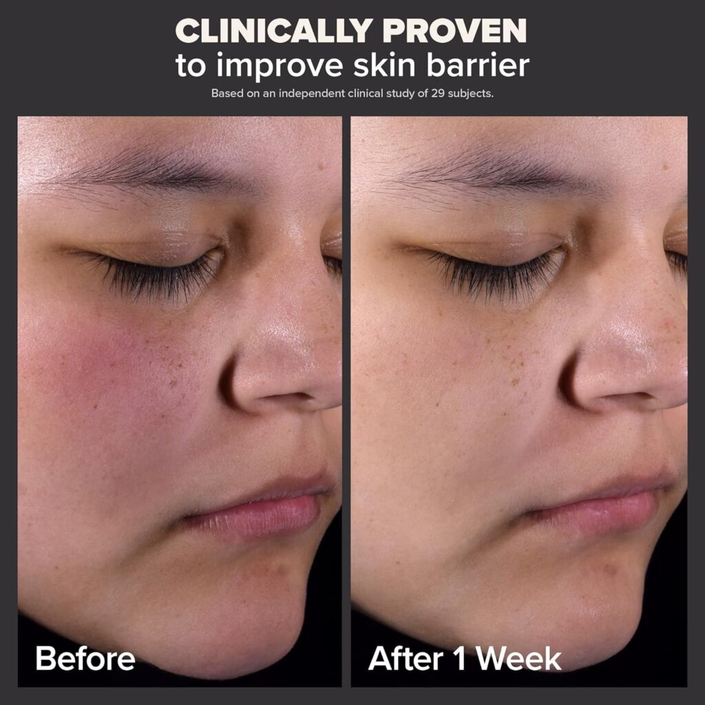 Improved Skin Texture and Radiance